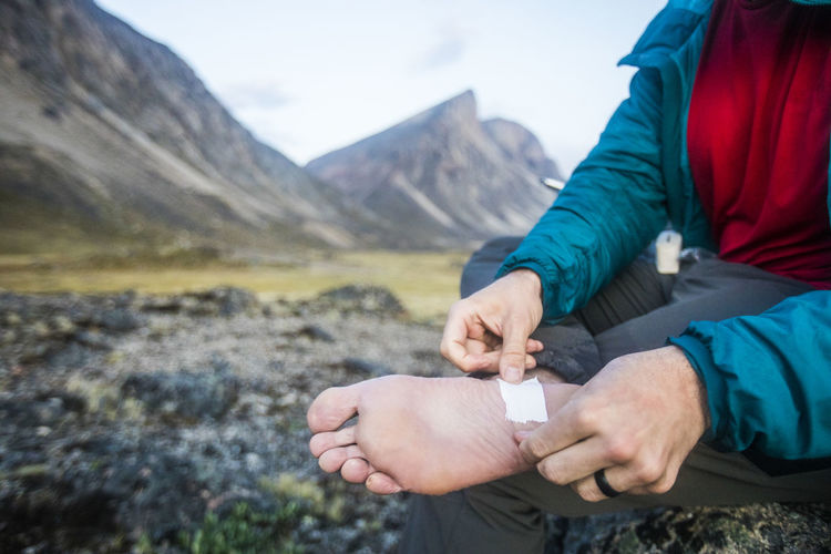 Hiker tapes foot where blister was forming on foot.