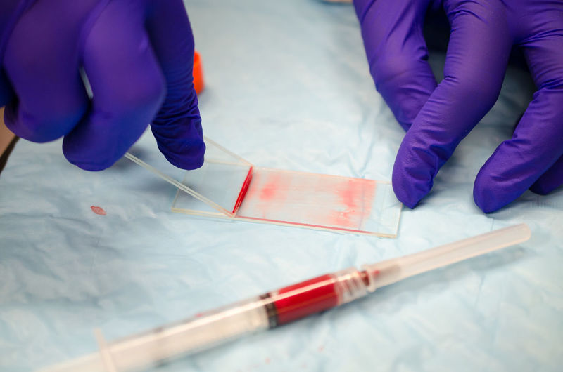 Cropped image of doctor testing blood