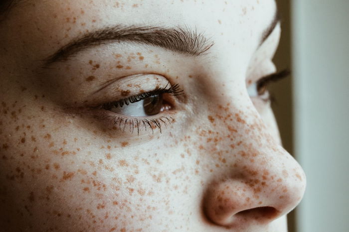 Close-up of thoughtful woman with freckles on face