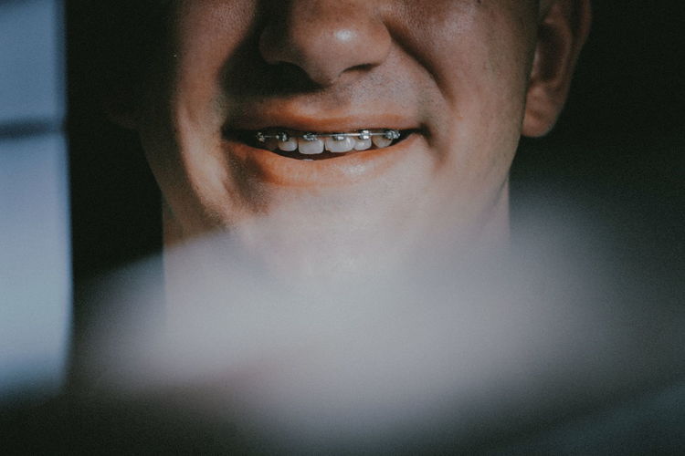 Midsection of smiling young man with braces