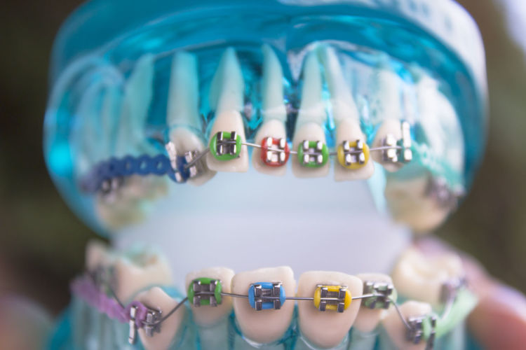 Close-up of dental equipment