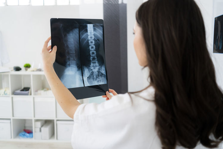 Female doctor examining spine x-ray at clinic