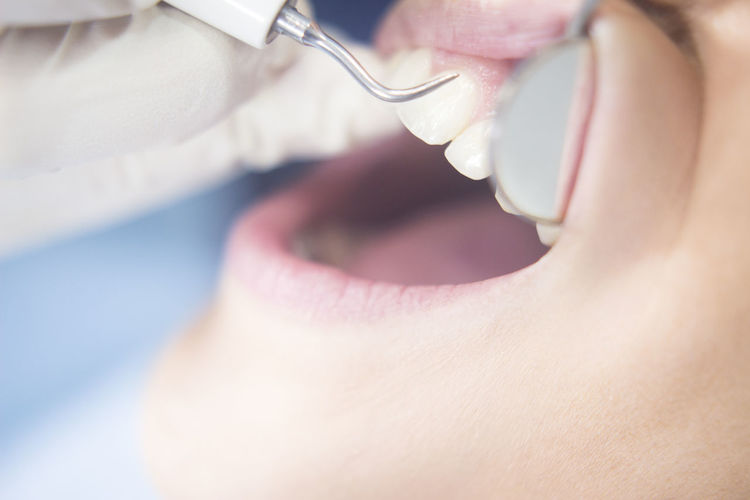 Close-up of patient during dental procedure