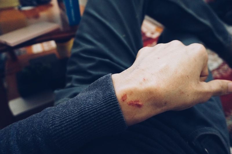 Midsection of man with scar on wrist