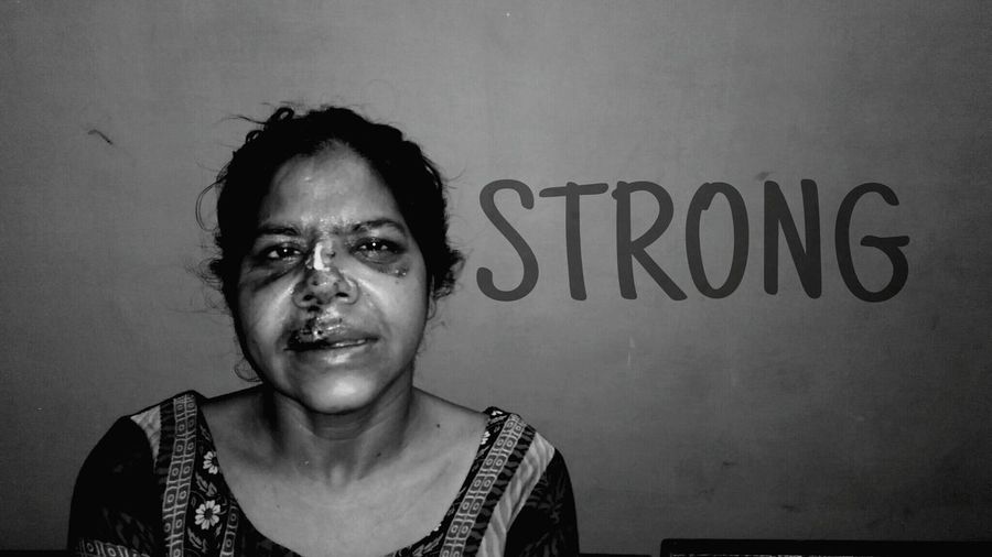 Portrait of acid victim with text on wall