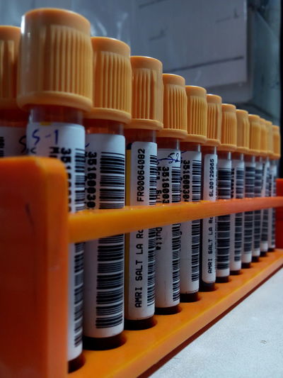 Samples in test tube rack
