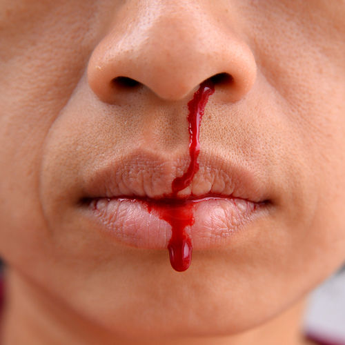 Cropped image of man bleeding