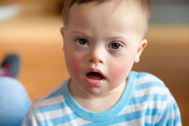 Close-up portrait of cute physically impaired boy