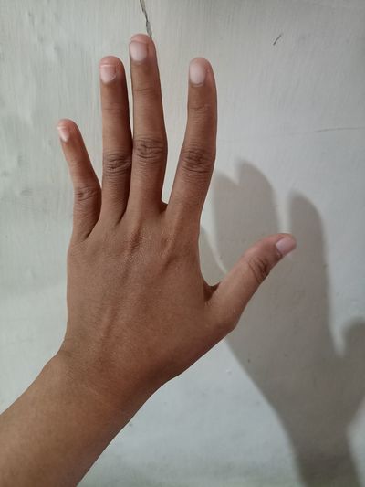 The finger of my left hand is ripe samo