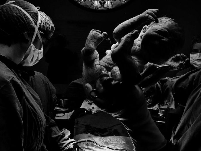 Newborn baby girl delivered in operating theatre surrounded by surgeons
