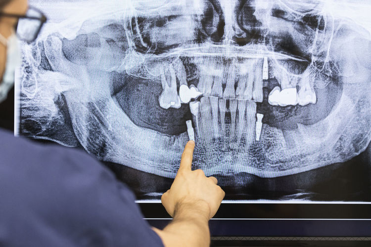 Male dentist examining x-ray at clinic