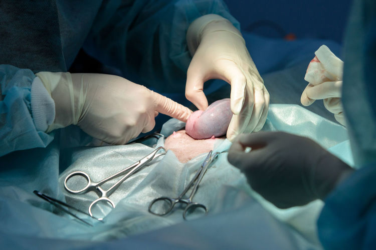 Veterinary surgery, operation, laparotomy concept. closeup of cesarean section of cat