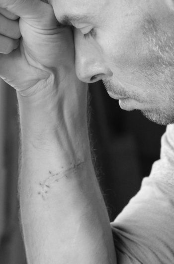 Close-up of depressed mature man with wounds
