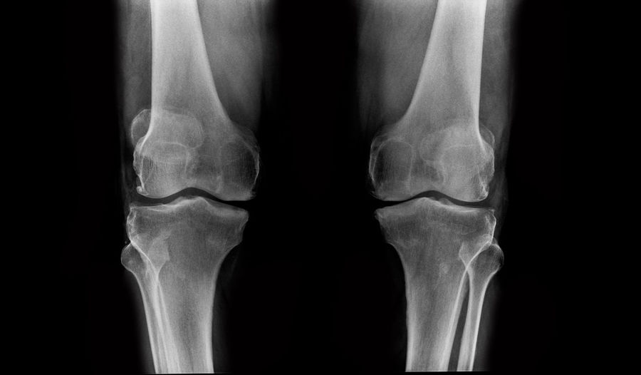 Full frame shot of x-ray