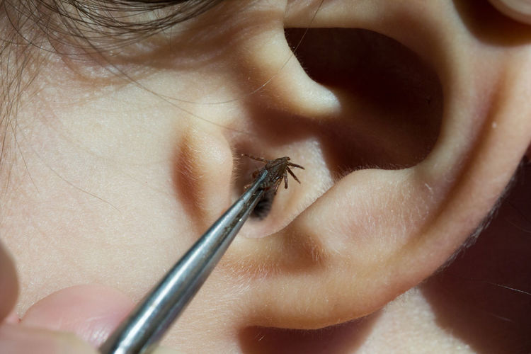 Close-up of insect in tweezers over human ear