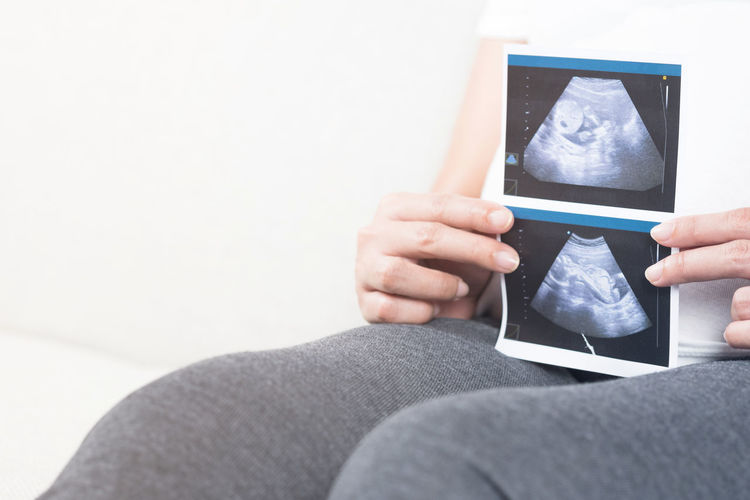 Midsection of pregnant woman holding ultrasound while sitting on sofa at home