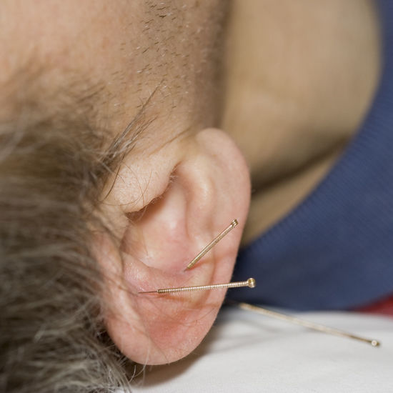 Cropped image of man with acupuncture needles on ear