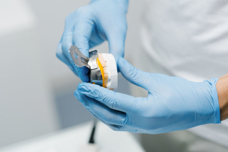 The dentist makes an impression of the teeth. close-up of a dentist in blue gloves