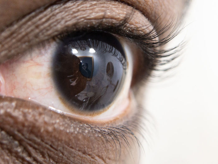 Close up of african american mans dark brown eyes for use in ophthalmology optometry imagery